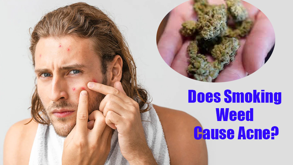 Does Smoking Weed Cause Acne? LOOKAH